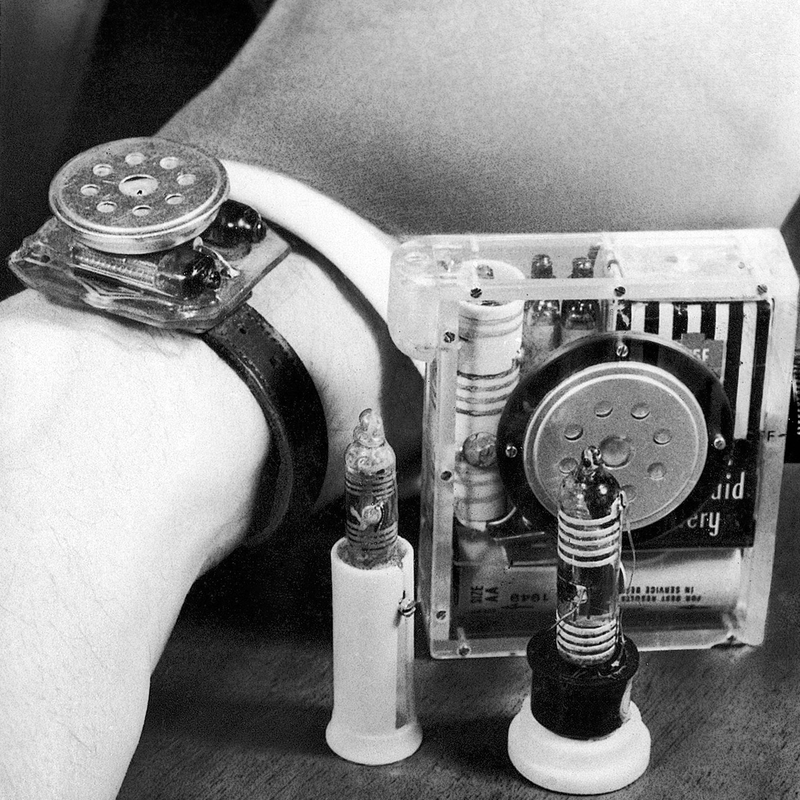 Illustration for article titled The Fantastic Wrist Gadgets That Came Way Before the Smartwatch